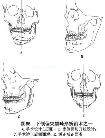 72300099d1e723d0ca9.jpg